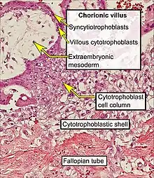 Histopathology of a chorionic villus, in a tubal pregnancy