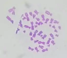 Micrograph of human male chromosomes using Giemsa staining for G banding.