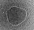 Human embryonic stem cell colony on mouse embryonic fibroblast feeder layer