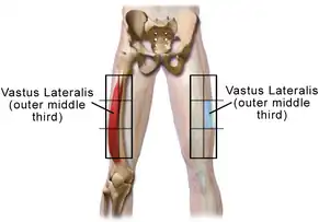 Vastus lateralis site in adult