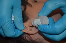 A gloved hand is holding a bottle of ear drops over an ear