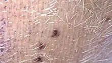 Magnified reddish leech bites on a cow's udder