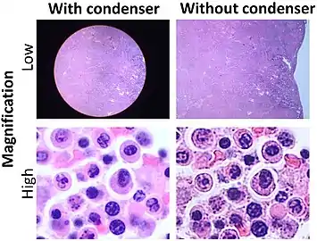 Light microscopy with and without condenser. At low magnification, using a condenser may limit the field of view, and in such cases it is preferable to not use it. At high magnification, a condenser makes borders less marked, and is generally preferable in such cases.