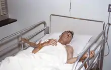 A man suffering from rabies tied to a hospital bed.