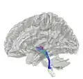 Tractography showing medial lemniscus