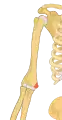 Right medial epicondyle colored in red.