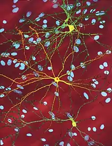 Several neurons colored yellow and having a large central core with up to two dozen tendrils branching out of them, the core of the neuron in the foreground contains an orange blob about a quarter of its diameter