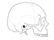 Occipitomastoid suture