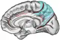 Boundaries of precuneus are defined by the three sulci. (shown in red) marginal branch of the cingulate sulcusparieto-occipital sulcussubparietal sulcus The area colored blue represents parietal lobe.