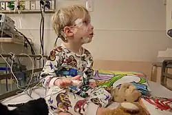 A child sits on a hospital bed in pyjamas with soft toys. Along with other measurement devices, the child has electrodes taped to their scalp and face.