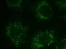 Peroxisome in rat neonatal cardiomyocyte staining The SelectFX Alexa Fluor 488 Peroxisome Labeling Kit directed against peroxisomal membrane protein 70 (PMP 70)