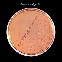 Plate with an active bacterial culture