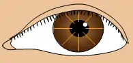 Schematic diagram of the radial keratotomy with incisions shown.