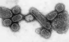 Transmission electron micrograph of influenza A viruses