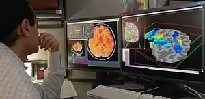 researcher looking at fMRI test