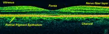 Time-Domain OCT of the macular area of a retina at 800 nm, axial resolution 3 µm