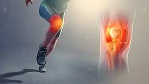 Chronic pain can be caused by joint or bone damage during heavy and irregular sports.