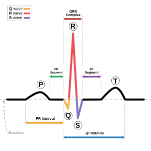 The EKG complex. P=P wave, PR=PR interval, QRS=QRS complex, QT=QT interval, ST=ST segment, T=T wave