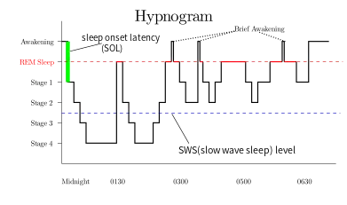 Hypnogram showing sleep cycles from midnight to morning.