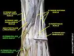 Extensor pollicis brevis muscle