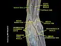 Basilic vein