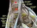 Lumbar and sacral plexus. Deep dissection. Anterior view.