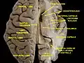 Ventricles of brain and basal ganglia. Superior view. Horizontal section. Deep dissection.