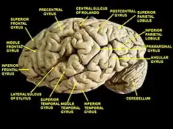 Cerebrum. Lateral view. Deep dissection. Superior frontal gyrus labelled at top-left.