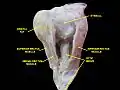 Extrinsic eye muscle. Nerves of orbita. Deep dissection.