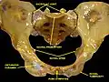 Pelvis. Anterior view.