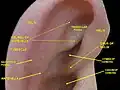 External ear. Right auricle. Lateral view.