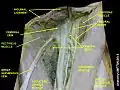 Pectineus muscle