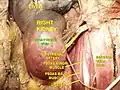 Right kidney