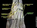 Extensor digiti minimi muscle