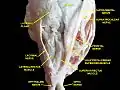 Extrinsic eye muscle. Nerves of orbita. Deep dissection.