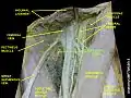 Femoral sheath