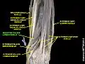 Abductor pollicis longus muscle