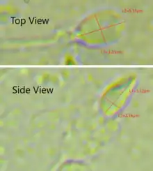 Dimensions of the human sperm head measured from a 39-year-old healthy subject.