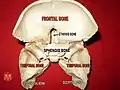 Sphenoid and temporal bones