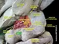 Dissection showing the stomach and pylorus in a cadaver. The antrum of the pylorus is shown in green.