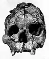 Talgai Skull