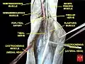 Tibial nerve