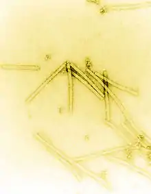 Transmission electron micrograph of TMV particles negative stained to enhance visibility at 160,000× magnification