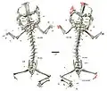 CT-scan