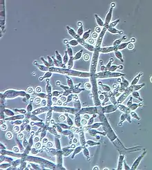 An aggregation of long, thin translucent cells that are multiply branched. Some of the terminal branches have a small circular cell at their tips.