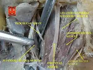 Superior rectus muscle