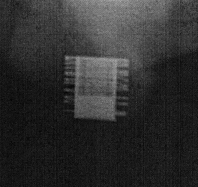 An X-ray image of implanted ZSI 375. The device is activated – the spring is decompressed at the top of the cylinder. Patient is continent.